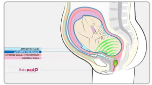Babypod vagina speaker could advertise to the unborn