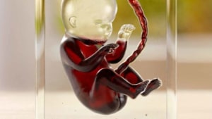 303 MullenLowe Perth exposes dangers of drinking alcohol while pregnant