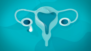 Ovary-reaction needed to beat Australia’s deadliest female cancer