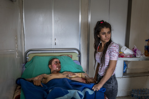 World Press Photo of the Year Nominee. &copy; Ivor Prickett, Ireland, for The New York Times. Injured Kurdish Fighter Receives Hospital Visit. Ahmed Ibrahim (18), a badly burned SDF fighter, is visited by his girlfriend at a hospital in Al-Hasakah, Syria, on 20 October. She had at first been reluctant to enter the room, as she was horrified by his injuries, but a nurse persuaded her to go in to hold Ahmed&rsquo;s hand and have a short conversation.