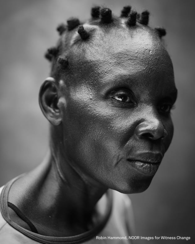 People - Second Prize, Singles. Praying for a miracle &ndash; mental health problems in disabling environments in Africa. Hellen (41) lives with a mental health problem. Her illness developed later in life. In developing countries, over 80 percent of people living with mental health problems do not receive any treatment. In African countries, treatment often comes in the form of prayer from a pastor or traditional healer. Modern medicine is available to very few. A mental health problem often means relegation to the margins of society; life in mental health facilities often doing more harm than good, and coming attached with crippling social stigma. Cultural beliefs and associations that link mental disorders to witchcraft are deeply rooted in some communities. &copy; Robin Hammond, NOOR Images for Witness Change.