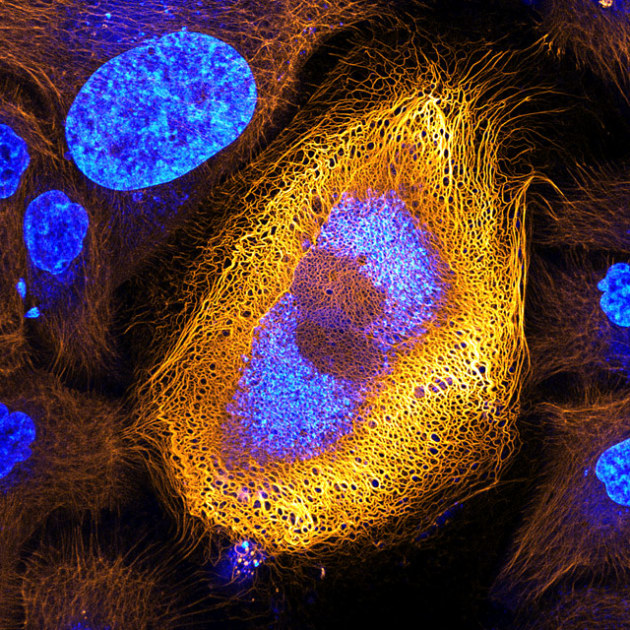1st Place. Image by Dr. Bram van den Broek, Andriy Volkov, Dr. Kees Jalink, Dr. Reinhard Windoffer & Dr. Nicole Schwarz 
The Netherlands Cancer Institute, BioImaging Facility & Department of Cell Biology, Amsterdam, The Netherlands. 
Subject Matter: Immortalized human skin cells (HaCaT keratinocytes) expressing fluorescently tagged keratin
Magnification: 40x (objective lens magnification).
