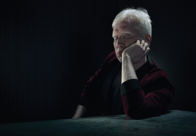Personal work. Jassim. Portrait
of a young Bangladeshi albino. &copy; Janyon Boshoff.
Grading by Limehouse creative.