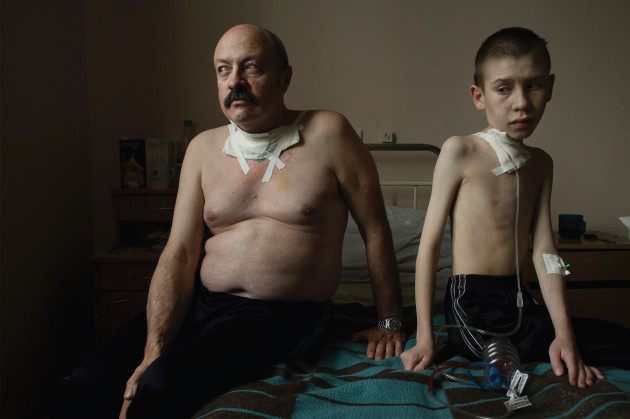Suffering from thyroid cancer, Oleg Shapiro, 54, and Dima Bogdanovich, 13, receive care at a thyroid hospital in Minsk, where surgery is performed daily. Belarus, 2005. &copy; Gerd Ludwig.