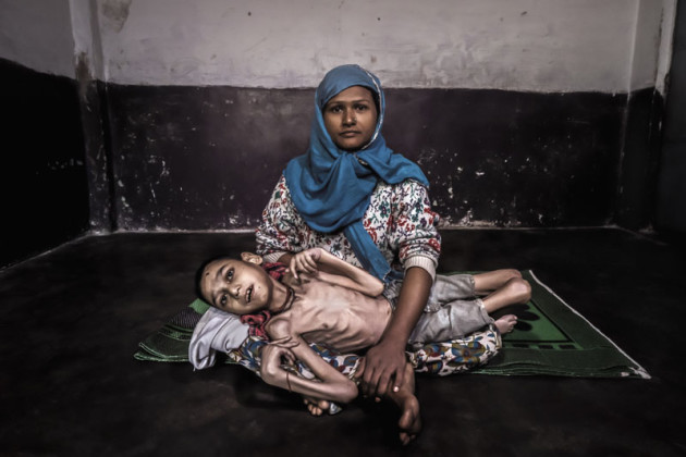Head On Portrait Prize - 2nd Place - Giles Clarke. &ldquo;Sameer, 16, is held by his mother Wahida at home in Bhopal's Jamalpura neighborhood. Sameer was born to parents contaminated by carcinogenic and mutagenic water stemming from the 1984 Union Carbide gas tragedy which has claimed 25,000 lives to date. For decades thousands of families have used contaminated water leading to serious illness and birth defects, as afflicted Sameer. The title refers to scholar-activist Sandra Steingraber's concept of toxic trespass, in which toxic chemicals enter our bodies without our consent.&rdquo;