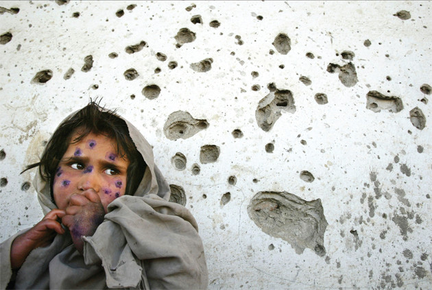 Mohboba, age 7, stands against a bullet-ridden wall waiting to be seen at a health clinic in Kabul. She has
the infection Leishmaniasis, that plagues a number of
poverty-stricken children in Afghanistan. March, 2002. &copy; Paula Bronstein