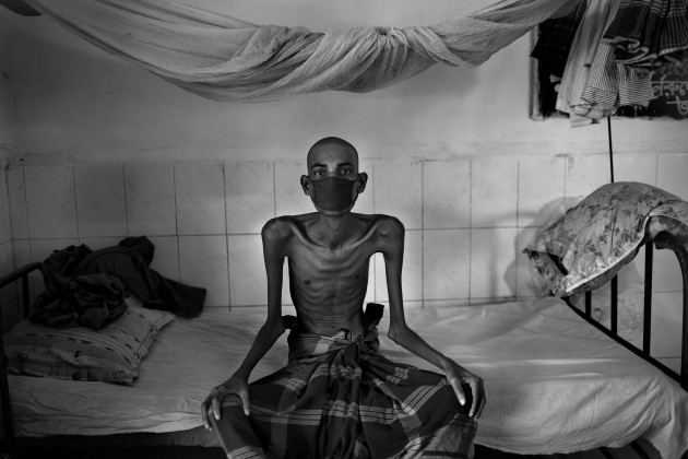 &copy; Probal Rashid. Tuberculosis in Bangladesh.