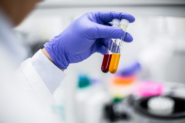 Samples from the propolis research study in the UniSC Science Lab. Image: University of the Sunshine Coast
