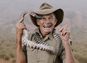 Photographer Jarrad Seng releases new project, 'The Story of Scars'