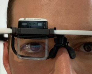 Revolution trials augmented reality for diagnostics